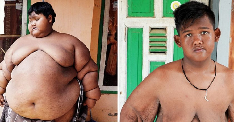 “Nothing Is Impossible”: The Fattest Boy With A Weight Of 421 lbs Has Lost Lots Of Weight And Changed Beyond Recognition!